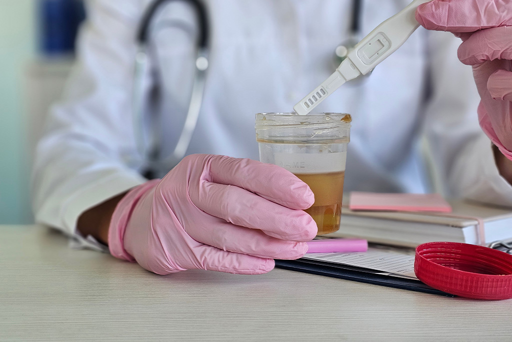 Orina con espuma: ¿qué indica sobre tu salud? – TENA